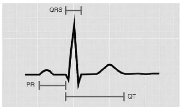 Fig. 1 QRS 폭