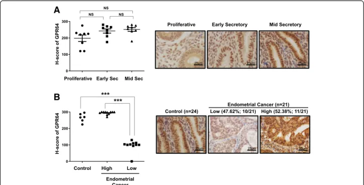 Fig. 1 Levels of GPR64 in human endometrial cancer. a Representative immunohistochemistry andsemiquantitative analysis for GPR64 expression in control endometrium from women in proliferative, early, and mid-secretory phases