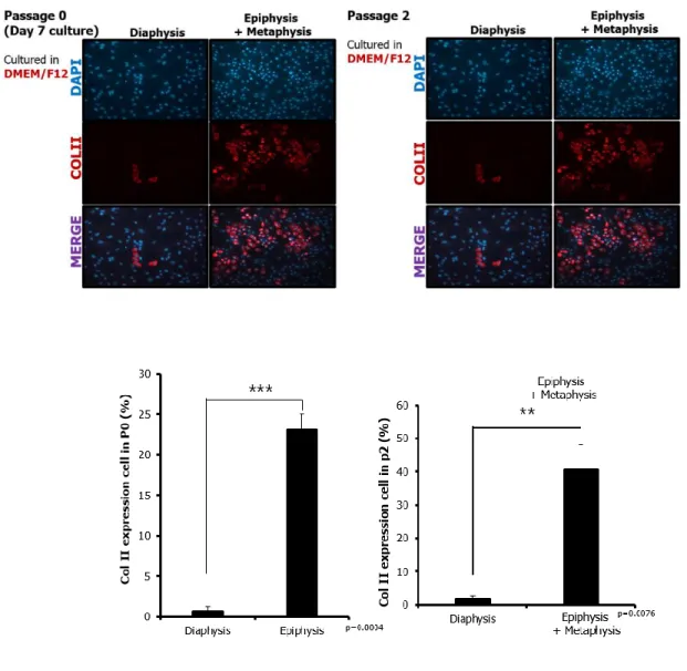 Figure 4. Col  Ⅱ  expression of epiephysis-metaphysis area and 