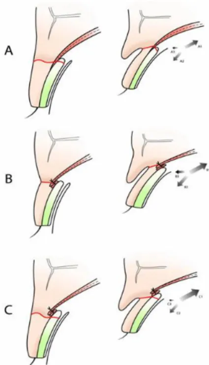 Fig. 1. Anatomy of the levator mechanism of the upper eyelid.