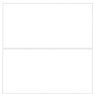 Fig. 4. Case of mild ptosis, preoperative (Above) and postoperative view (Below).
