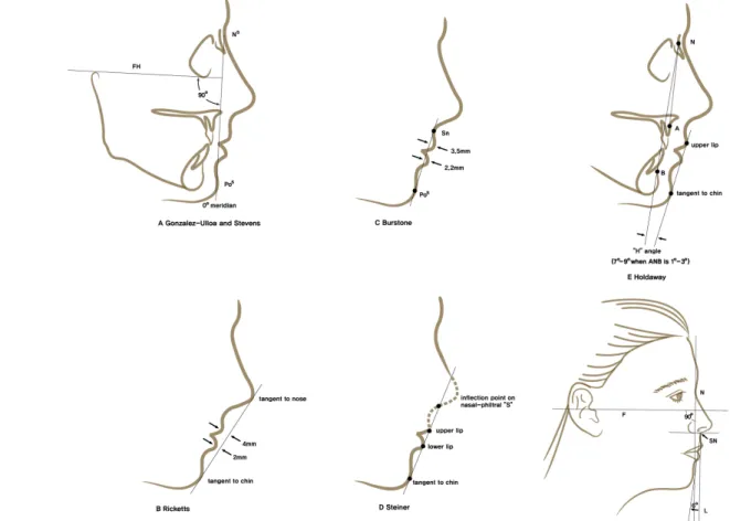 Fig. 1. Various ideal facial profile. (Above, left) Gonzalez-Ulloa and Stevens, (Below, left) Richetts, (Above, center) Burstone, (Below, center), Steiner, (Above, right) Holdaway, (Below, right) Guyuron.