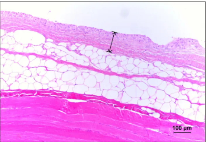 Fig. 5. Tissue obtained: Capsule with adjacent soft tissue was resected simultaneously.