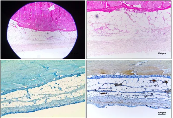 Fig. 8. Thickness of capsule: negative control 345.5 ± 21.9 m; positive control 306.4