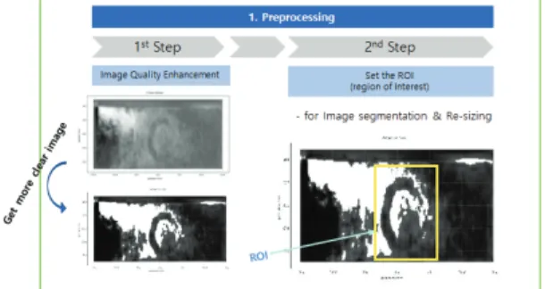 Fig. 6. 1 st  processing of the algorithm. preprocessing step  for image quality enhancement and setting the ROI