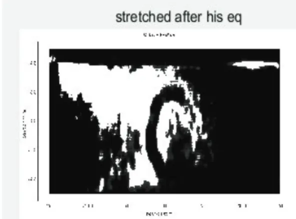 Fig. 12 는 hist st와 hist eq를  순차적용  후 Sobel을  추가로  적 용한  결과물이다. 
