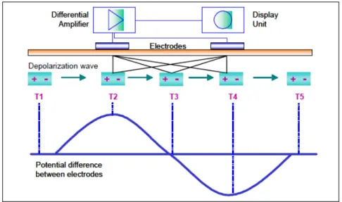 Figure 7. Bipolar electrode  를  통해  근섬유  표면에서  측정되는  EMG  신호의  측정  원리  (P. Konrad, 2005) 