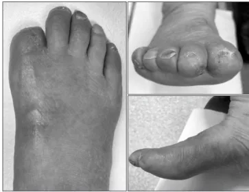 Figure 4. Bilateral lower extremity blood flow showed full recovery on  the follow-up 3-dimensional computed tomography angiography