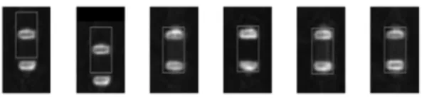 Fig. 2 Training image examples with a wrong aligned image.