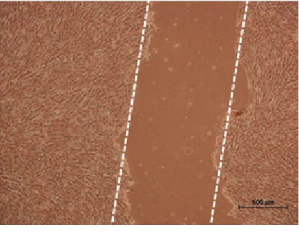 Figure  8.  Scratch  wound  closure  model  using  HaCaT  cell  migration. 
