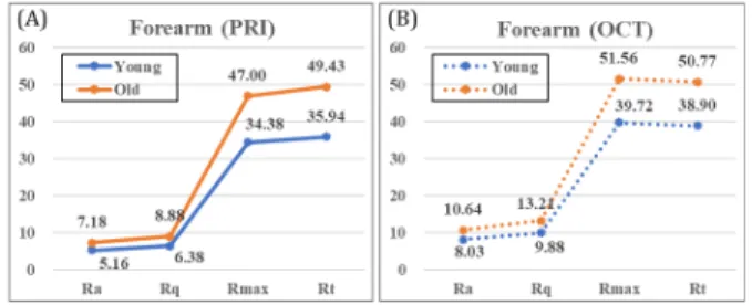 Figure 4. Results of Ra, Rq, Rmax, Rt parameters in forearm  imaging, (A) PRIMIS and (B) OCT.