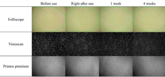 Figure 5. Visual changes in the skin surface photographed by Folliscope, Visioscan, and Primos premium during the trial period