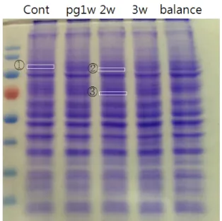 Fig.  1.  단백발현  변화  분석  실험  절차 Fig.  2.  P.  gingivalis로  감염되지  않은  또는  감염된  구강편평 세포암종  세포내  단백질  발현  변화  관찰  소견  (Coomassie  blue  염색) 기영동  두  가지  방법으로  각각  분리하였다