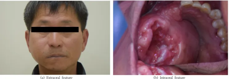 Fig.  1.  Pre-operative  features.