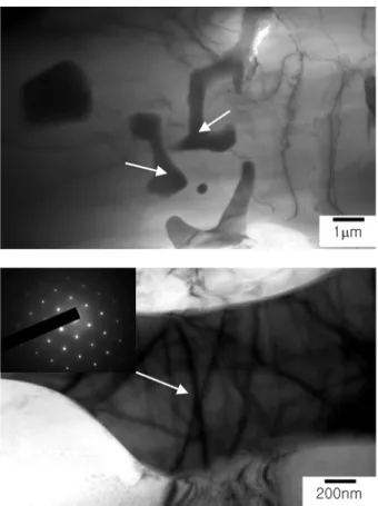 Fig. 6. TEM micrographs of Al-7%Si-0.4%Mg-1%Fe-0.7%Mn alloy showing Si phases ([011] Zone Axis).