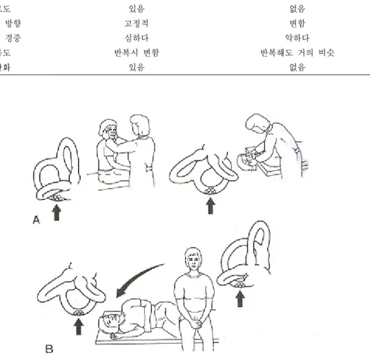 Figure  3. 체위변환검사.  A:  Dix‐Hallpike  maneuver    B:  Sidelying  Test.