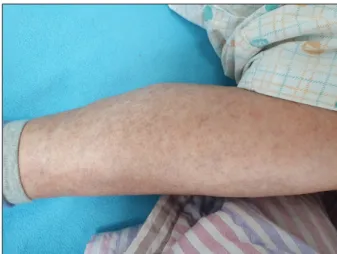 Figure 1. Rash on the left arm. Figure 2. Rash on the left leg.