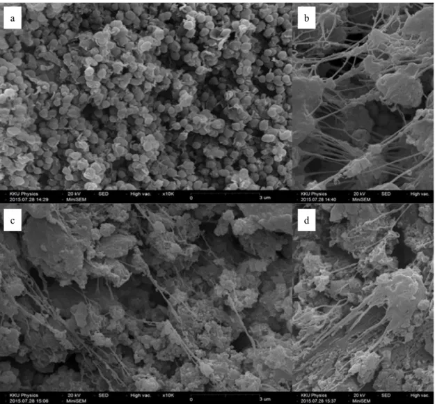 Fig. 2. SEM pictures of polyethylene using BC-1 and BC-2 catalyst with different Al/Ti mole ratios; (a) BC-1,  Al/Ti  =  70,  (b)  BC-2,  Al/Ti  =  70,  (c)  BC-2,  Al/Ti  =  480,  (d)  BC-2  with  1-hexene,  Al/Ti  =  480MW and Tm of PE