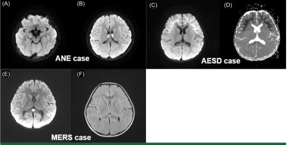 Table 2.  Pathogens Proven in Patients with Acute Encephalitis and Encephalopathy following Infectious Symptoms