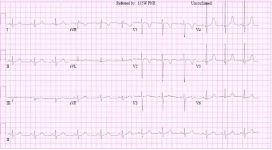 Fig. 2. His resting electrocardiogram shows prolonged QT interval(QTc 477 ms).