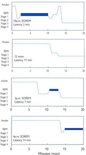 Fig. 4. Example of a multiple sleep latency test in narcolepsy. At the 10 a.m., 2 p.m., and 4 p.m.