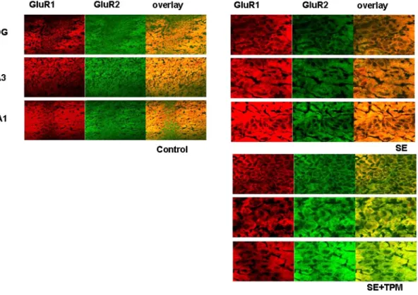 Fig. 4. Effects of TPM on differential expression of GluR1 and GluR2 after kainate-induced SE in mouse pup hippocampus