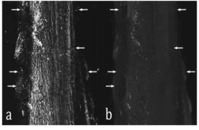 Fig.  1.  Maximum  Intensity  Projection  (MIP)  of  CRM  (a)  and  CLSM  (b)  micrographs