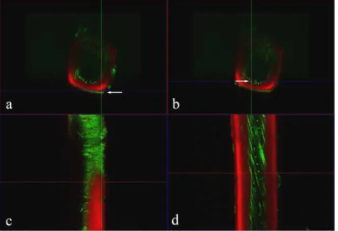Fig.  3.  Grayscale  picture  of  Figure  2c.  The  upper part  of  the  fiber  showed  very  rough  surface (top  arrow),  but  the  lower  part  of  the  fiber showed  very  smooth  surface  compared  to  the  upper  part  (bottom  arrow).
