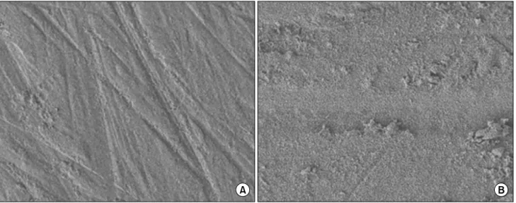 Fig.  3.  SEM  images  show  zirconia  surface  textures  (×250).  (A)  No  etching  zirconia  group,  (B)  zirconia  group  with  etching.