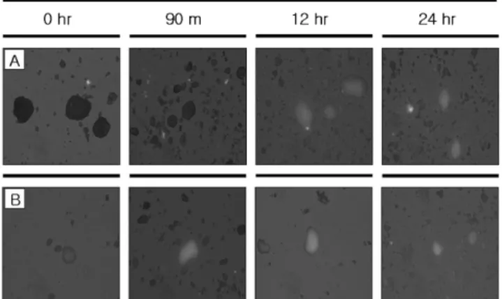 Fig. 8. Fluorescent microscope image (×400 magnification) illustrating  S. mutans labelled with DAPI, hydroxyapatite under transmission light and an image overlay illustrating S.