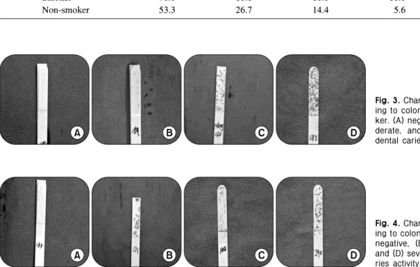 Fig. 4. Change of SM strip accord- accord-ing to colony density in drinker. (A)  negative,  (B)  mild,  (C)  moderate,  and (D) severe levels of dental  ca-ries  activity.