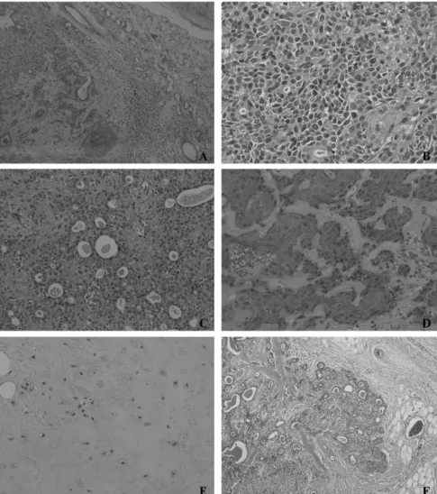 Fig. 1.  The pleomorphic adenoma showing variable histopathologic patterns (A) with plasmacytoid myoepithelial cells (B), ductal structures lined with cuboidal cells (C), well-differentiated sqaumous cells which are surrounded with typical myxoid zones (D)
