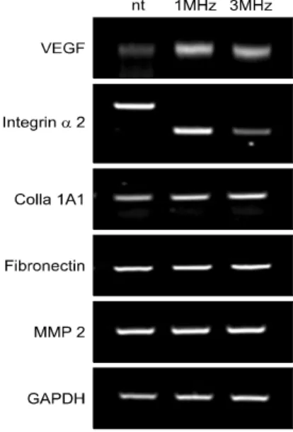 Fig.  4.  The  results  of  reverse  transcription-polymerase  chain  reaction analysis