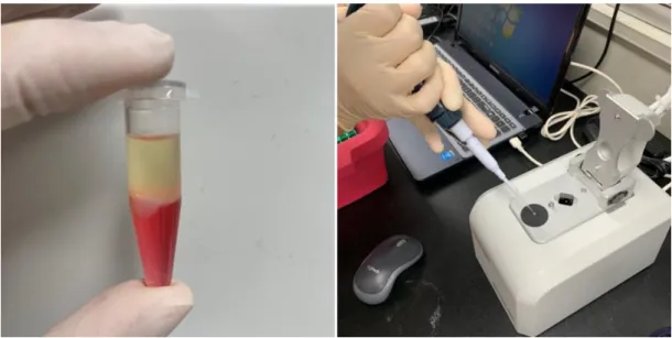 Figure 5. Measurement of mRNA concentration and cDNA synthesis for the qPCR analysis 