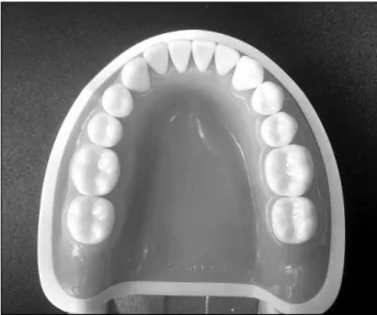 Fig.  1.  Lower  full  arch  model  (500B-1,  Nissin  Dental  Products, Kyoto,  Japan).접촉식은 touch probe를 사용하여 측정물의 3차원 형상 데이터를 얻는 방법이고, 비접촉식은 빛, 센서 등을 이용한다