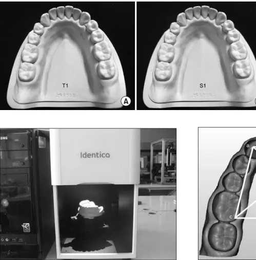 Fig.  3.  Scanning  process  (Identica,  Medit,  Seoul,  Korea).