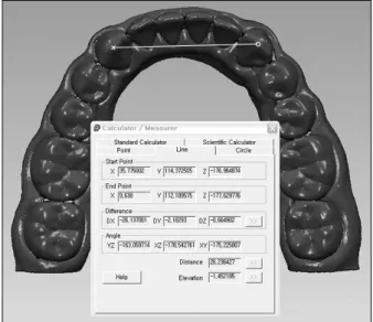 Fig.  5.  Digital  model  measurement. Measurement Descriptive Master-type IV (+value=master is larger) System significanceMasterType IV p-value b Mean±SD a Mean±SD a a∼b 27.13±0.17 26.57±0.15 0.56 0.001 c∼d 38.67±0.16 38.25±0.18 0.42 0.001 a∼c 27.18±0.21 