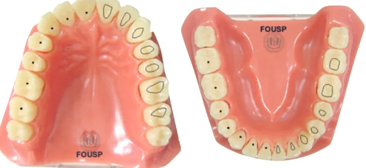 Figura 2 - pontos de eleição e formas de contorno para dentes superiores e inferiores