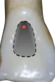 Figura 4 - Forma de contorno de  incisivos superiores e inferiores