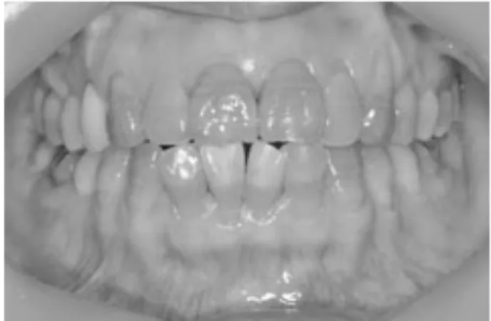 Fig. 2. Pretreatment panoramic radiograph.