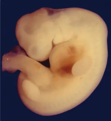 Fig. 10-8. Embrión del estadio 14 de la quinta semana (31 a 32 días), vista  izquierda