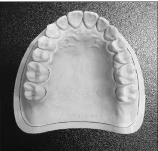 Fig.  1.  Study  model.