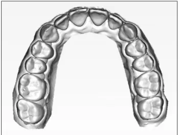 Fig.  3.  Non-contact  dental  scanner.