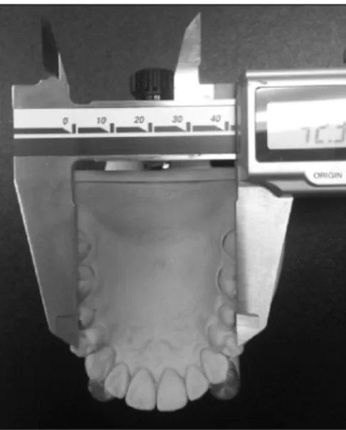Fig.  5.  Measurements  of  stone  models  using  digital  vernier  calipers.