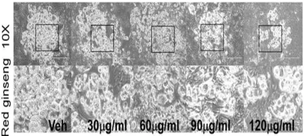 Figure 3. TG accumulation in 96-well culture plates was visualized. 3T3-L1 cells were seeded and induced to differentiation in the presence of DMSO (vehicle control), RG (30-120 ug/ml) for 8 days: