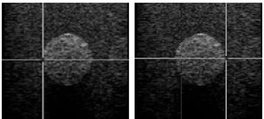 Figure  4.  A  typical  ultrasonic  image  to  +15dB  LCS  target.  Pointing  out  using  mouse  the  location  of  the  edges  in  either  sides  of  the  target  to  identify  its  circular  boundary,  a  circle  whose  circumference  coincides  with  th