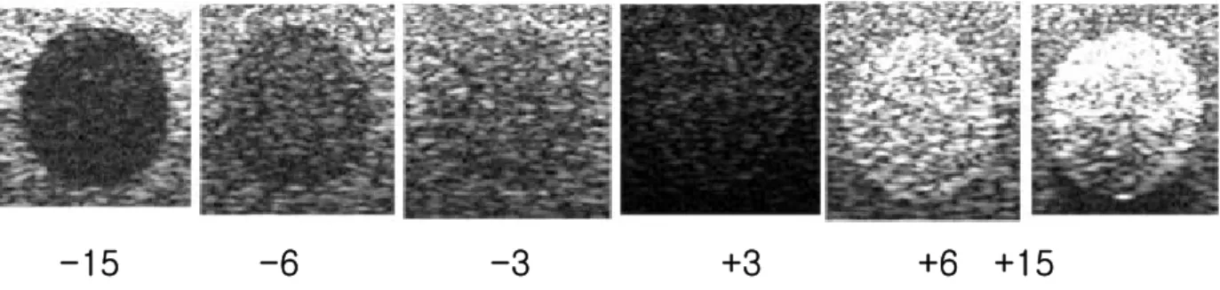 Figure  12-1  Ultrasonic  images  of  the  LCS  targets  obtained  at  settings  of  TGC  max,  Gain  mid,  DR  40dB,  freq