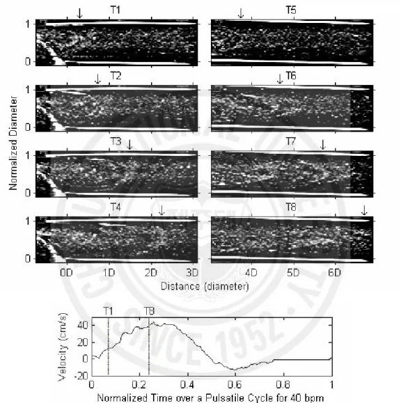 Fig.  3.  Consecutive  snap  shots  of  B-mode  images  during  accelerating  phase  of  pulsatile  flow  (40 bpm) downstream of a stenosis