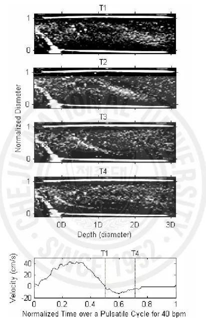 Fig. 7. Snap shots of B-mode images from whole porcine blood during diastole of pulsatile flow  (40 bpm) downstream of a stenosis