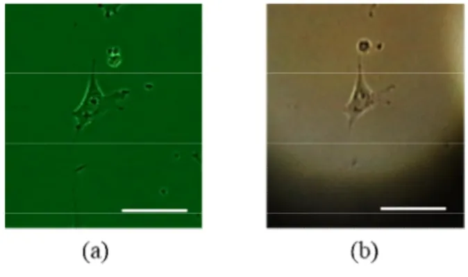 Figure  2.5-2 A  typical  image  of  the  HT-22  cell,  (a)  taken  from  a  conventional  microscope  and  (b)  obtained with the present microscopic setup
